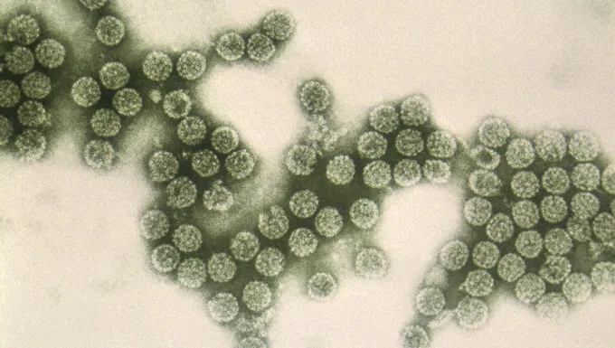 Micrographie électronique colorisée montrant des grappes de polyomavirus.