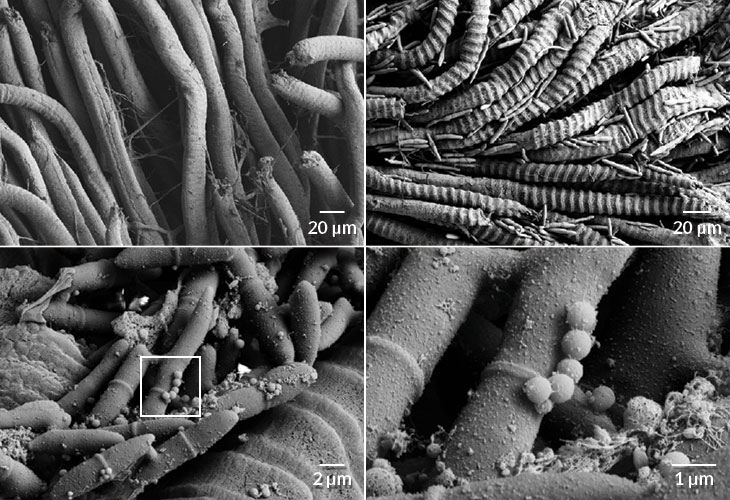 Images de microscopie électronique montrant l'altération des fibres musculaires et des particules sphériques