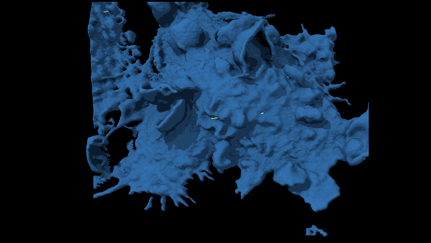 Cellule de leucémie échappant à un macrophage