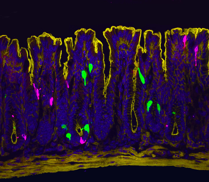 Coupe de côlon de souris montrant différentes populations cellulaires colorées en violet, vert et rose.