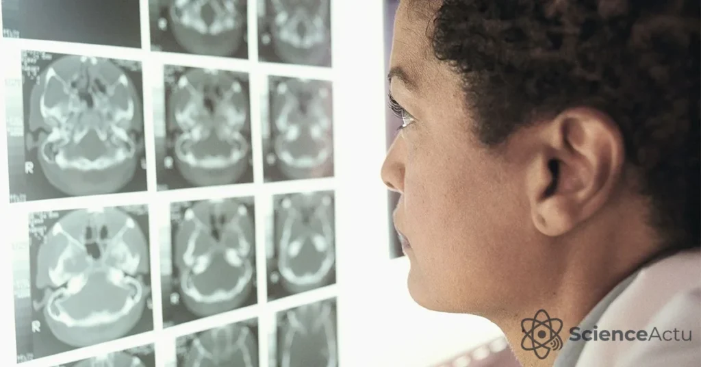 Maladie liée aux IgG4 : symptômes et nouvelles thérapies