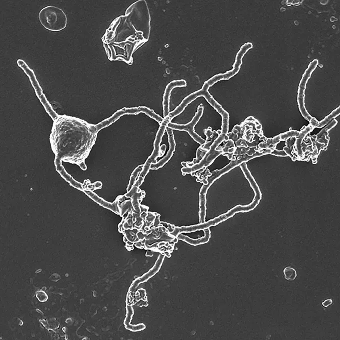 Microscopie d'une archée d'Asgard
