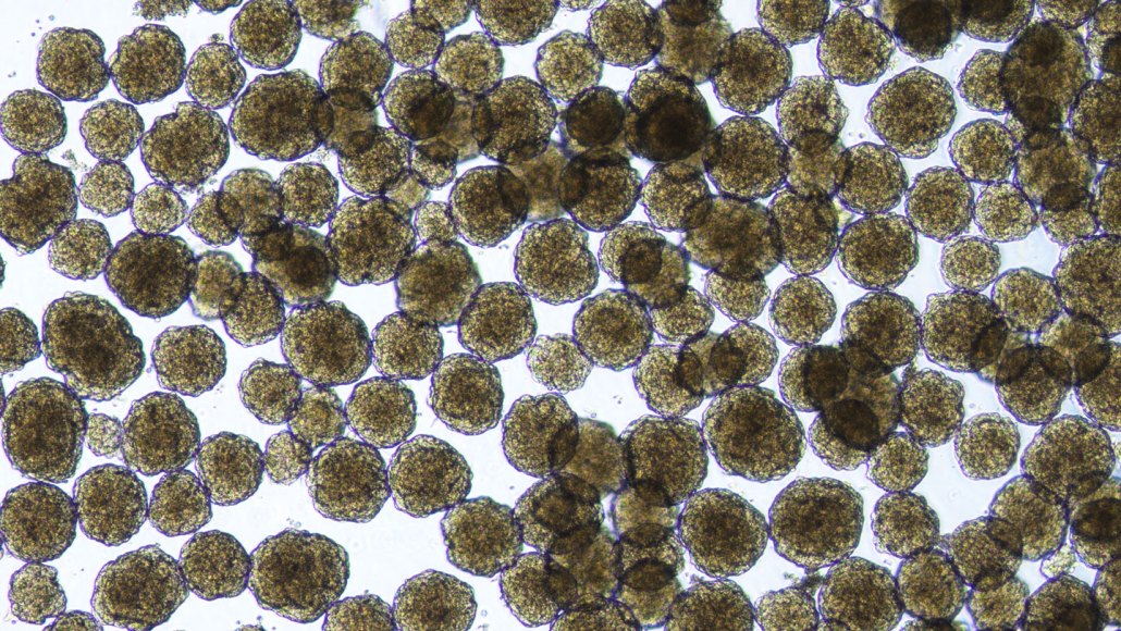 Amas de cellules d'îlots pancréatiques humains créés en laboratoire