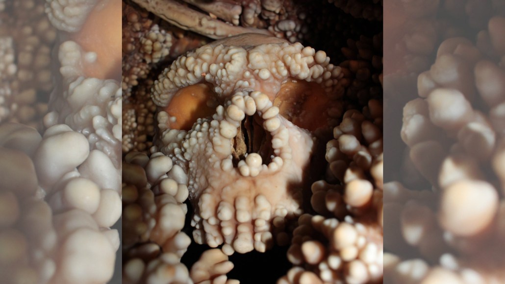 Crâne fossilisé de l'Homme d'Altamura recouvert de calcite