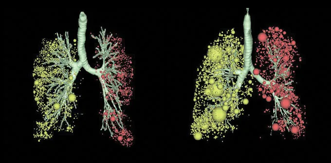 Modélisation 3D des poumons humains montrant les ramifications