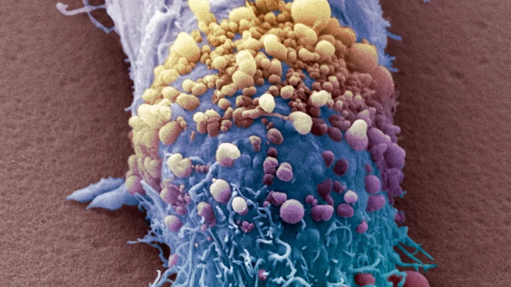 Illustration associée à un vaccin personnalisé contre le cancer